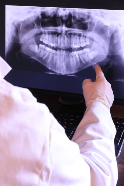 Best Emergency Tooth Extraction in Trezevant, TN